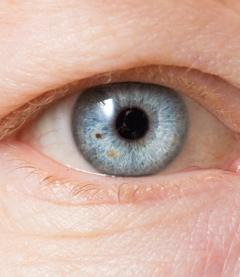 Dott. Daniele Cardillo - Oculista